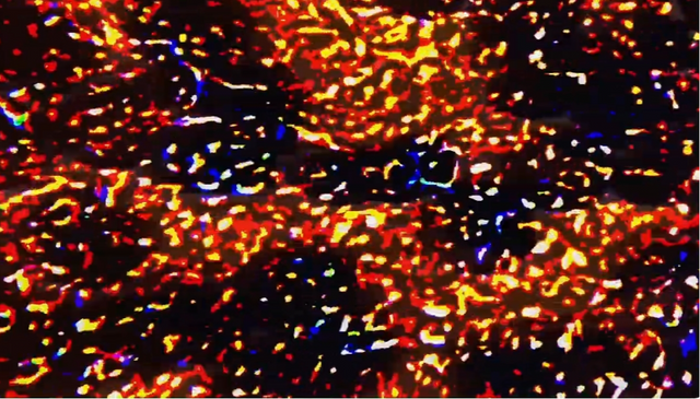 El cuerpo dentro del cuerpo