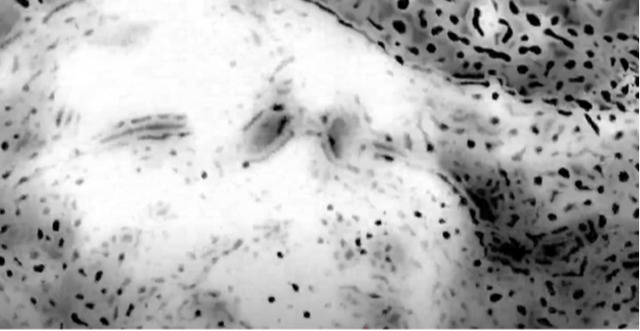 Corpúsculos, grumos, puntos ... realidades paralelas